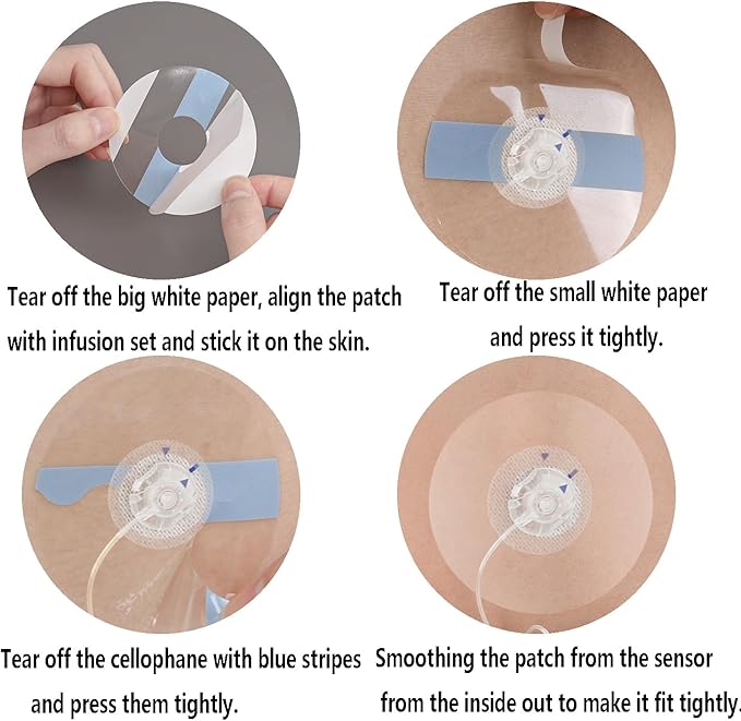 30 Pcs Waterproof Infusion Site CGM Adhesive Patches for Medtronic 780G/770G, Tandem t:Slim X2/ Mobi - Hypoallergenic Sensor Adhesive Tape with 0.8" Hole, 14-Day Wear, Pre-Cut Breathable Clear Patch