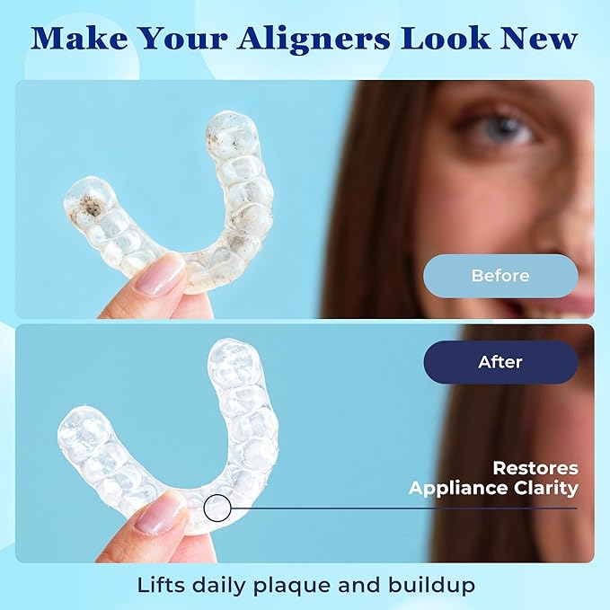 Aligner Cleaner Foam - Aligner and Retainer Cleaner Foam for Invisalign, Night Guards and Dentures, Helps Remove Stains & Build-Up, Keeps Appliances Clear, Fresh Mint Flavor, Travel-Friendly