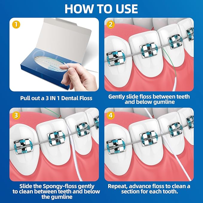 Bopika Dental Floss for Braces, 3 in 1 Ultimate Floss, Floss Threaders for Bridges and Implants, 80 Pre-Cut Strands (Pack of 2)