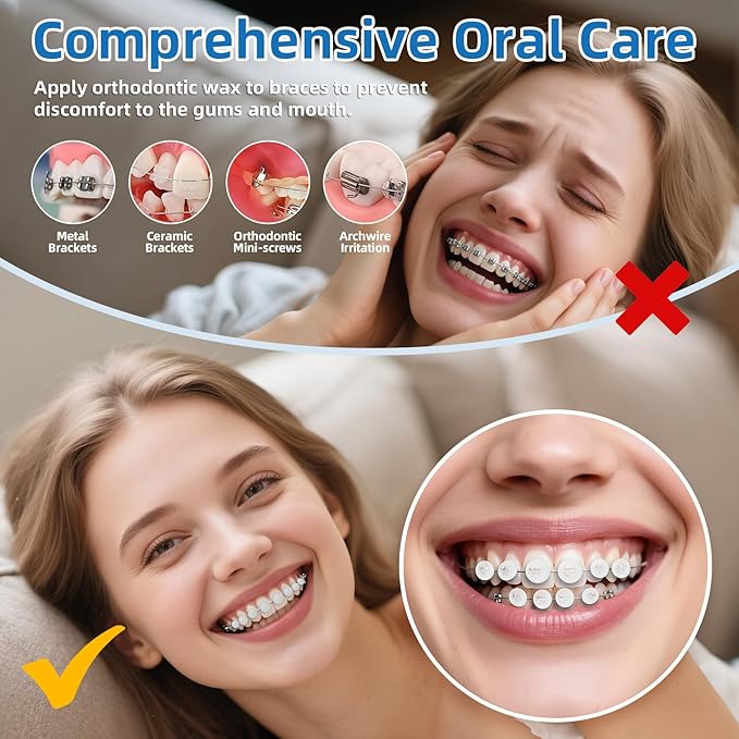 RioRand Orthodontic Wax for Braces Wax 120 Individual Hygienic Packaging Clear dental Wax Dots Portable and Easy to Tear Mint