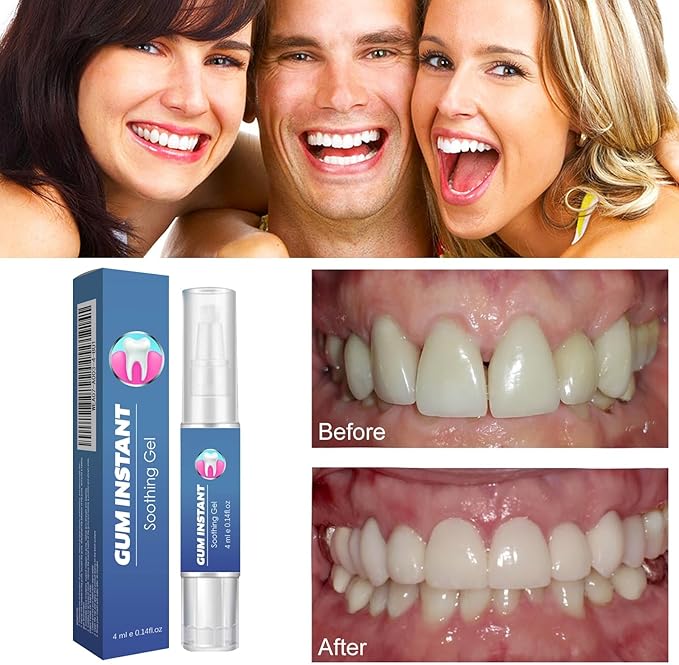 Gum Instant Soothing Gel for Gum Care, Teeth Whitening, Plaque Removal, 4ml, 0.14fl oz