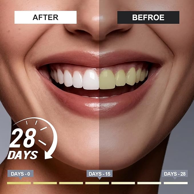 Woadee Hydroxyapatite Toothpaste for Advanced Enamel Protection, Fluoride-Free Nano Hydroxyapatite Toothpaste, Gentle and Effective Formula, Fresh Breath, Suitable for Sensitive Teeth 4 Pack
