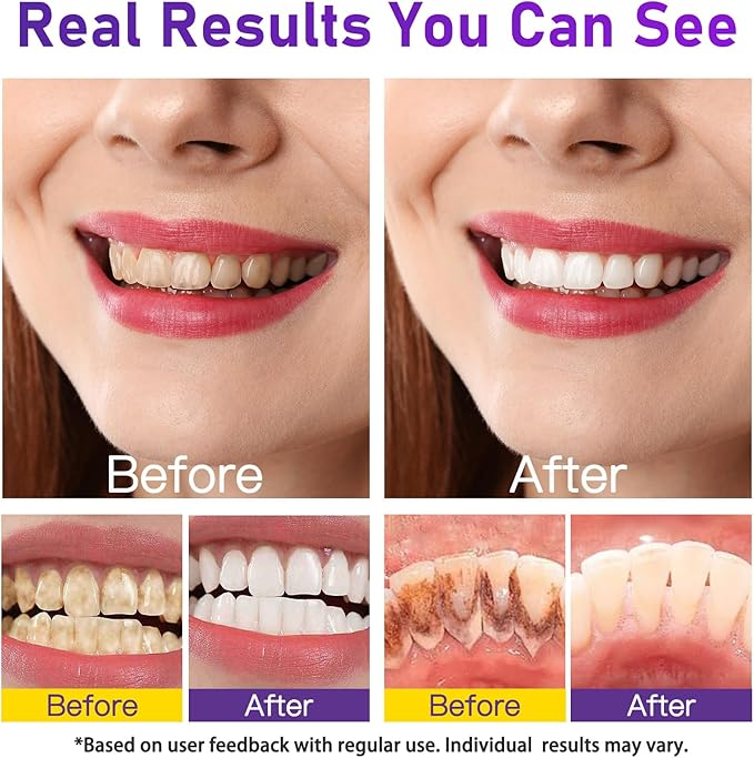 Teeth Whitening Powder - Teeth Whitening - Removes Stains - No Sensitivity - Enamel-Safe Toothpaste Power - Breath Freshener - for Coffee, Tea and Tobacco Stains 15g