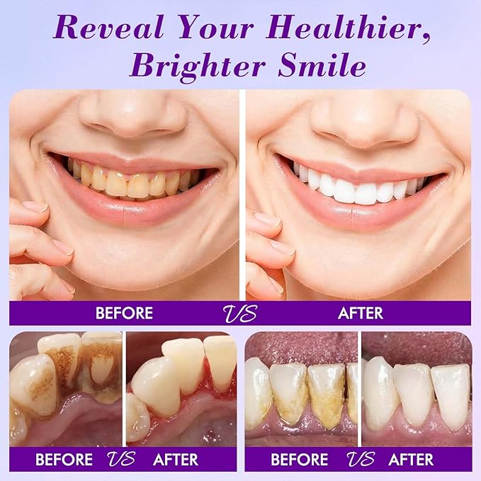 2 PCS Teeth Whitening Powder, Hydroxyapatite Remineralizing Tooth Powder with Niacinamide,R5X Advanced Purple Color Balance Immediate Results, Mint Flavor, 2 * 50 Grams