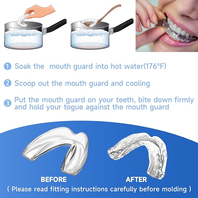Blue Kids Mouth Guard for Clenching Grinding Teeth,4 Pack Comfortable Night Guard,Moldable Child Bite Guard for Clenching Teeth,Mouthguard for Kids