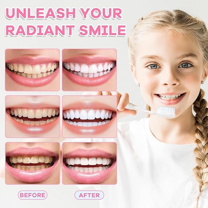 Niacinamide Whitening Toothpaste, Niacinamide Intensive Whitening Toothpaste, Enamel Protection & Long-Lasting Fresh Breath, Stain Removal - Daily Use for Improves Gum Health, Deep Cleaning Care (2)