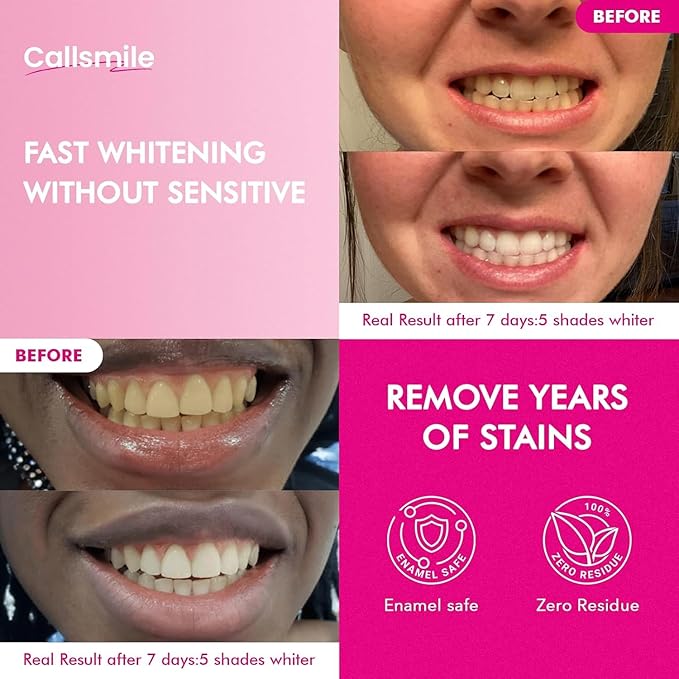 Callsmile Teeth Whitening Strips: 32 Treatment – Formulated for Sensitive Teeth – Gentle & Fast Whitening at Home, Removes Coffee, Tea & Smoke Stains, No Residue “Peel & Go”