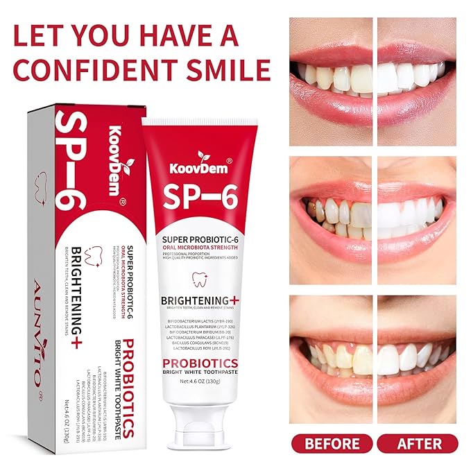 2025 New Sp-6 Probiotics Whitening Toothpaste-Fluoride-Free, Enhanced Formula with 6 Probiotics for Gum Care & Fresh Breath, Fresh Mint Flavor(1PC)（Red）