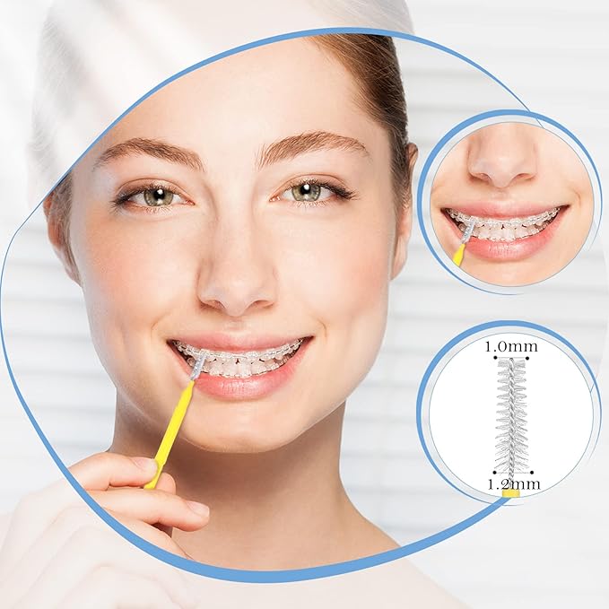 Honeydak 6 Pieces V Shaped Orthodontic Toothbrush for Brace with Brush Head 40 Pieces Interdental Brush Soft Bristle Braces Brushes for Cleaning Portable Toothbrushes for Braces(Small,Yellow)