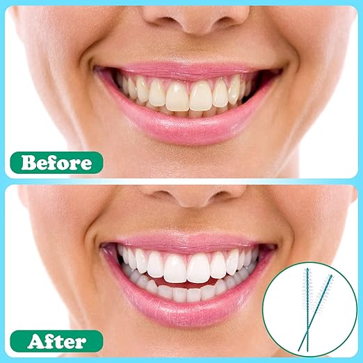 Interdental Brush Soft Dental Picks Tooth Floss Interdental Brush Betweens Refills White Refills for Tooth Cleaning (Small,30 Pieces)