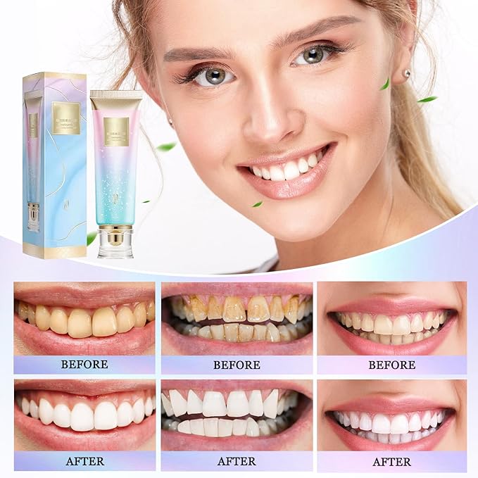 Dazzle White 2Pcs Niacinamide Whitening Toothpaste, Fresh Breath, Remove Tooth Stains
