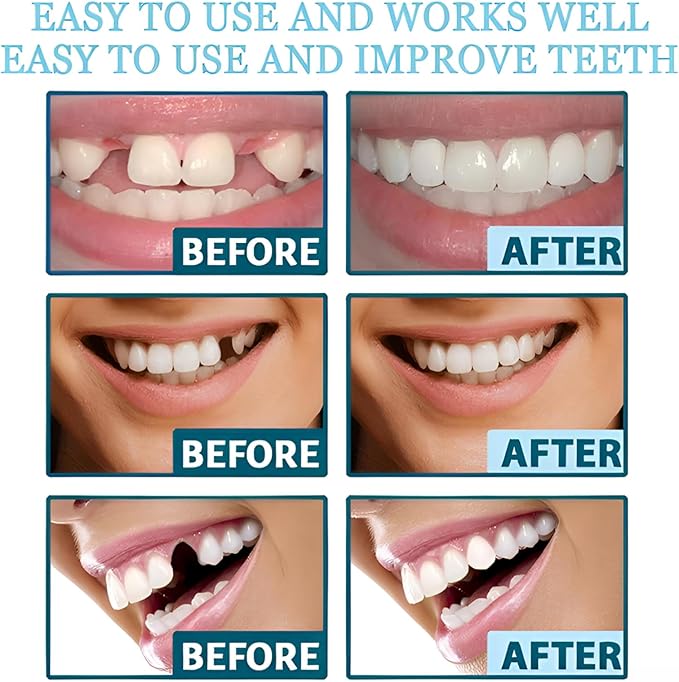 2 Pairs of Beautiful Smiles Both Men and Women Can Regain Their Confident Smiles. Upper and Lower Teeth Set. wear and for Temporary use