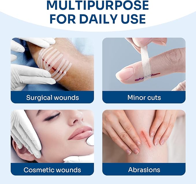 Conkote Wound Closure, Breathable Strips Hold Small Wounds Firmly Closed, Great After Sutures or Staples - 40 Wound Closures