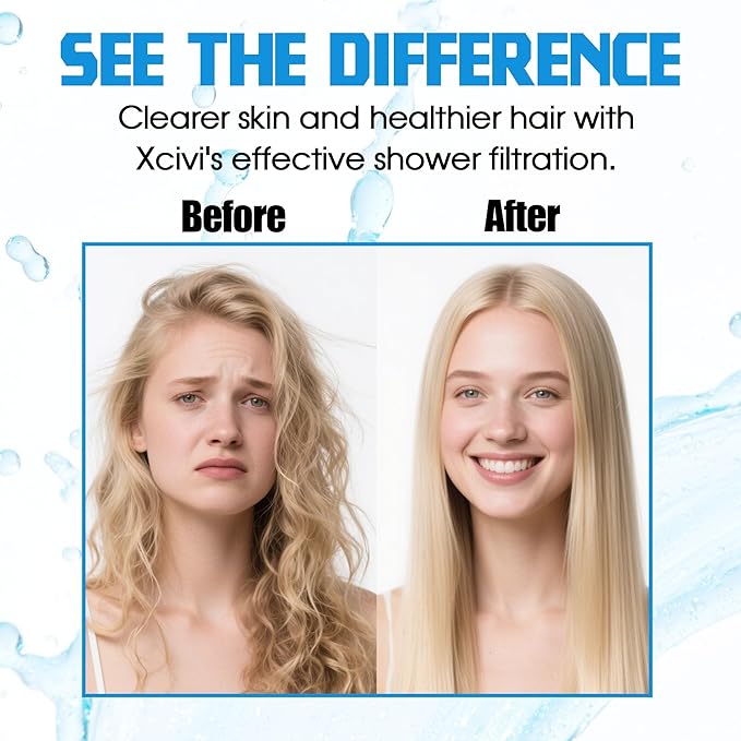 xcivi Vitamin C + E + A Shower Filter Replacement Cartridge for Aquahomegroup Shower Head, Shower Head Filter Supports Healthier Skin, Hair & Nails - 3 Packs