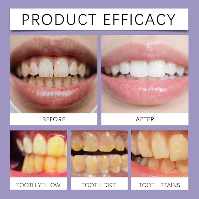Bee Venom Toothpaste for Gum Care & Enamel Strength - Breath Freshening Formula, Fights Plaque, Daily Cleaning for Oral Hygiene, Mint Flavor