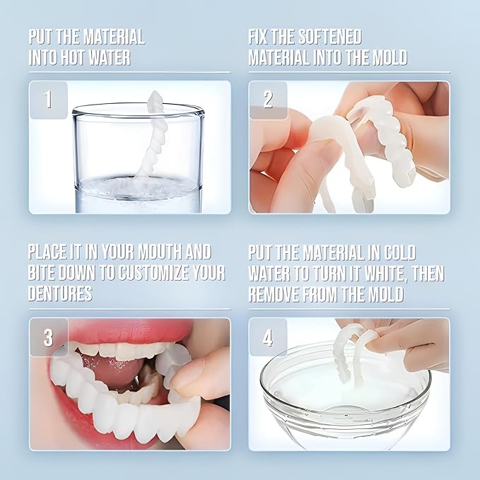 2 Pairs of Smile Supports, Quickly Restore Smile and Regain Confidence (White) Adjustable Comfort.