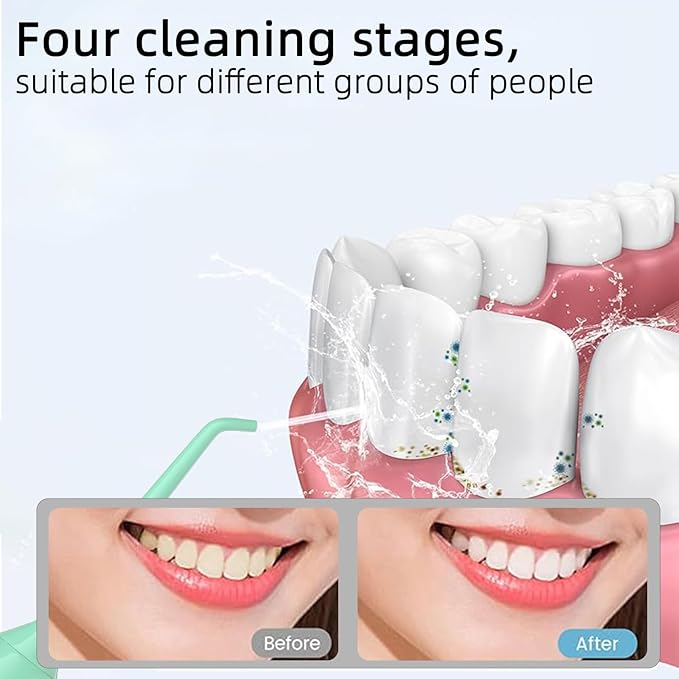Water Dental Flosser Teeth Pick: Portable Cordless Oral Irrigator 320ML Rechargeable Travel Irrigation Cleaner with 5 Flossing Tips, IPX7 Waterproof Electric Flossing Machine for Teeth Cleaning