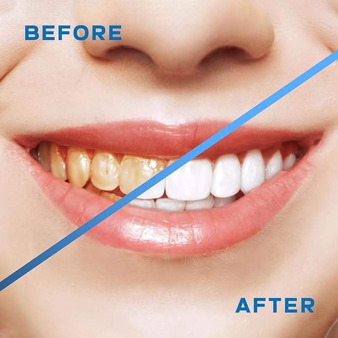 Cordless Water Flosser for Teeth Cleaning – 300ML Detachable Tank Oral Irrigator with 5 Tips & 5 Modes, IPX7 Waterproof, USB Rechargeable Dental Pick for Braces, Gums & Travel