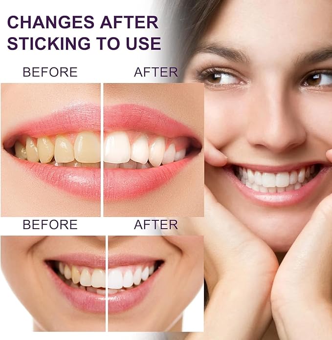 Purple Toothpaste for Teeth Whitening, Purple Whitening Toothpaste for Adults,Tooth Stain Remover Gel - Tooth Whitener Suitable for Smoking, Coffee, and Removing Dental Stone ﻿ ﻿ ﻿