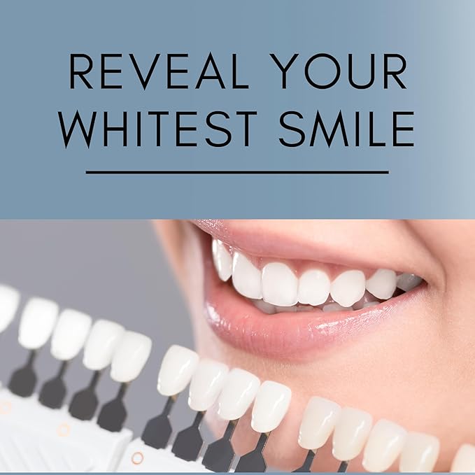 Teeth Whitening Gel for Trays - Professional Strength 44% Carbamide Peroxide, 5 Syringes (50 Treatments) + 2 Trays – Enamel Safe, Removes Coffee & Other Stains