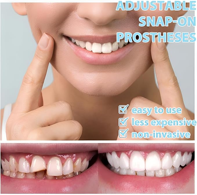 2 Pairs of Smile Supports, Quickly Restore Smile and Regain Confidence (White) Adjustable Comfort.