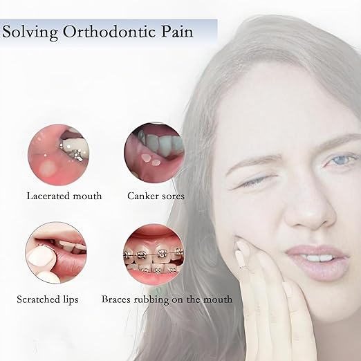 Orthodontic Wax for Braces 10 Boxes 50 Strip Odorless Braces Wax Dental Wax for Aligner, Dental Care, Prevent Mouth Injury