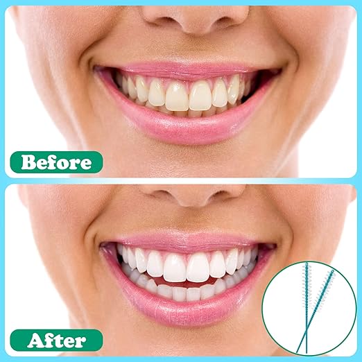 Interdental Brush Soft Dental Picks Tooth Floss Interdental Brush Betweens Refills White Refills for Tooth Cleaning(Small,60 Pieces)
