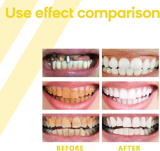 Propolis Gum Care Gel with Allantoin, Arginine and Calendula Extract, Soothing Oral Care Formula for Gingival Comfort and Mouth Health, Natural Ingredients, 4ml