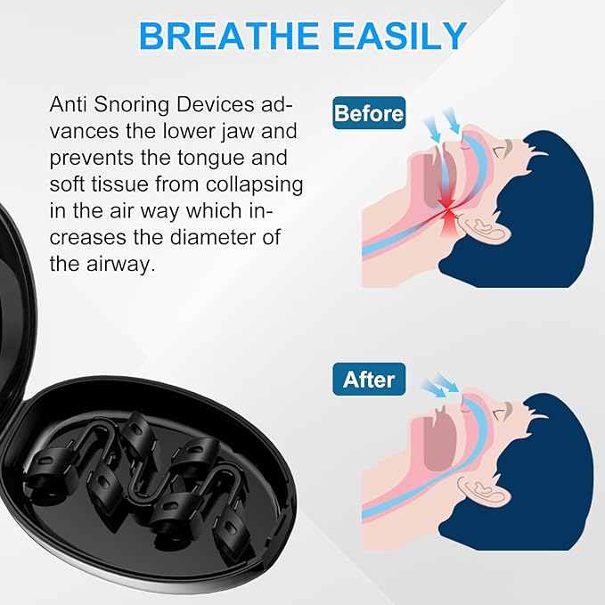 Anti Snoring Devices, Nasal Dilator for Sleeping, Effective to Relieve Snoring, for Nasal Snorers, Reusable Snoring Device to Enjoy a Peaceful Night's Sleep - 3 Pack (S)