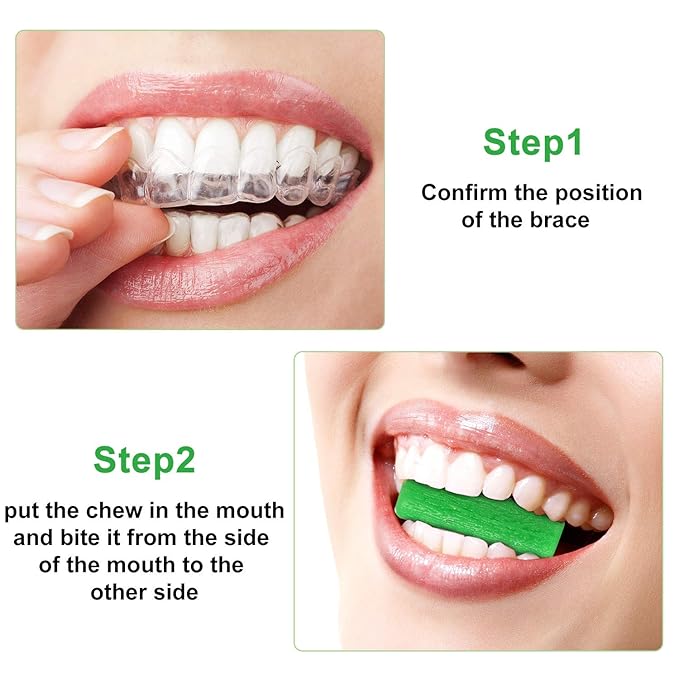 20 Pieces Aligner Tray Seaters for Aligner Trays Chompers Orthodontic Trays(Green)