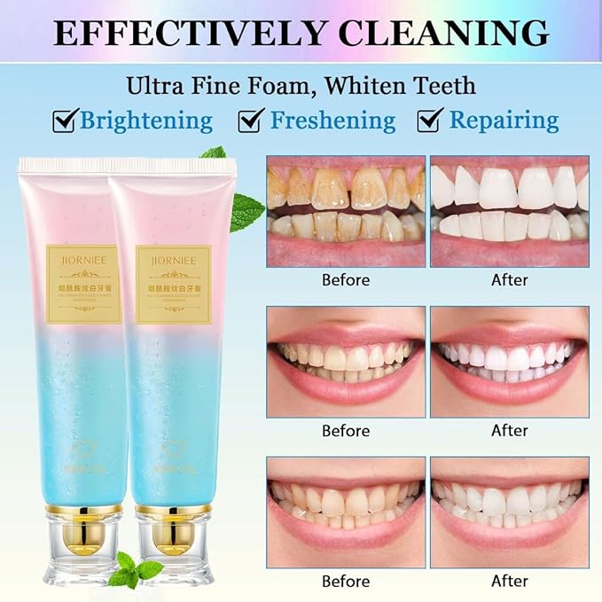 Niacinamide Whitening Toothpaste,Remove Tooth Stains,Improves Gum Health Fresh Breath 3.53 oz/ 100g (1)