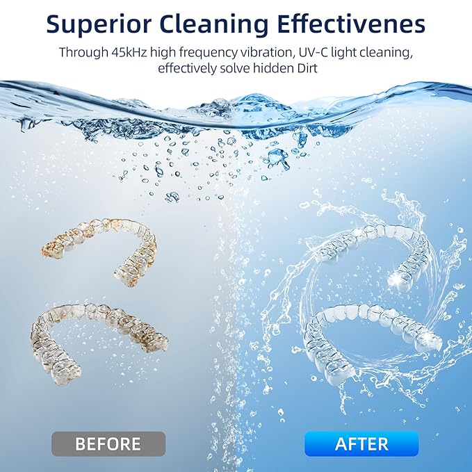 Ultrasonic Retainer Cleaner, Retainer Cleaner Machine for Dentures, Mouth Guards, Braces, Toothbrush Heads, Jewelry with 200ML Capacity, 45kHz Retainer Cleaning, 4 Modes for All Denture Brush