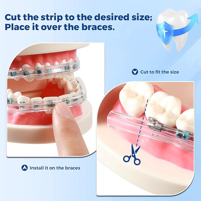 B Rush Comfort Cover for Braces -Orthodontic Lip Bumper, Lip Shield, Mouth Guard for Brackets, Wax Alternative-Dental Lip Protector