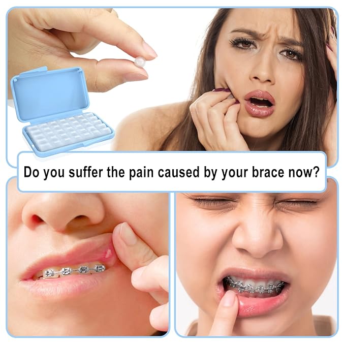 BVN Braces Wax Dental Wax: 10 Boxes Orthodontic Wax Strips, Braces Wax for Teeth, Ortho Wax for Braces, Tooth Wax, Mouth Wax, Oral Wax for Braces, Relief Wax for Braces Wearer Aligners Patients