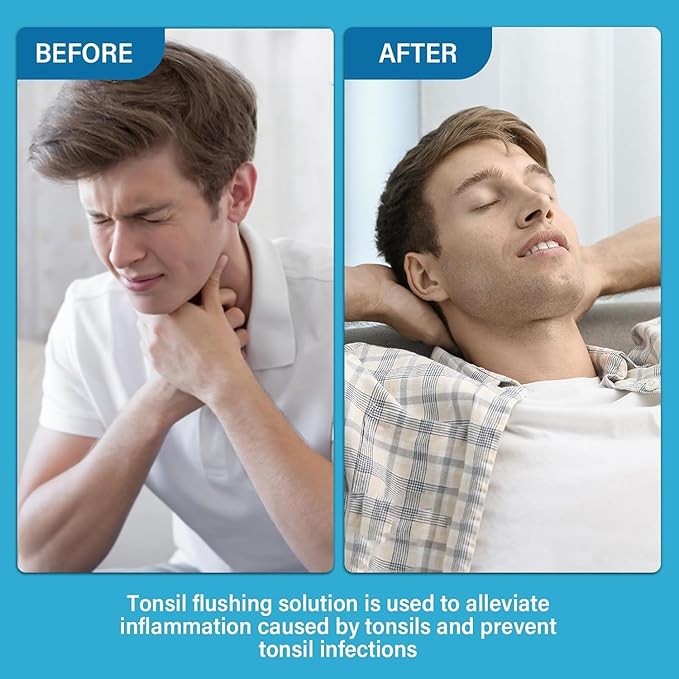 Tonsil Stone Mouthwash, Mint Oral Rinse Liquid Helps Soothe Tonsils, Freshen Breath, Moisturize Mouth, Gently Clean, 100ml