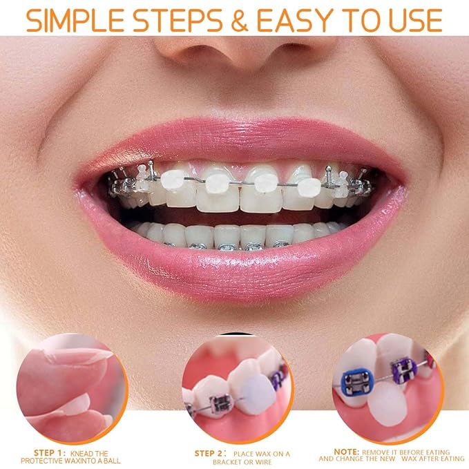 OBTANIM 24 Pack Colorful Braces Wax Dental Care Orthodontic Wax for Braces Wearer (10 Color)