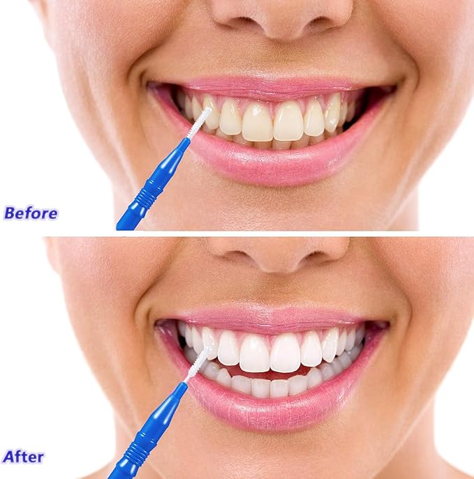 HOMSFOU 50 Pcs Care Tool Interdental Tooth Floss: Plastic Tooth Floss Toothpick 2. 5mm, Dental Head for Daily Oral Hygiene, Teeth Cleaning Tool & Oral Care Accessories for Home & Travel, Blue