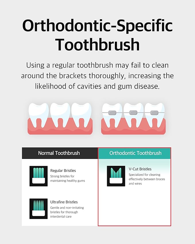 V-Cut Orthodontic Toothbrush (White) – Pack of 6, Medium Bristles, Ergonomic Manual Toothbrush for Adults