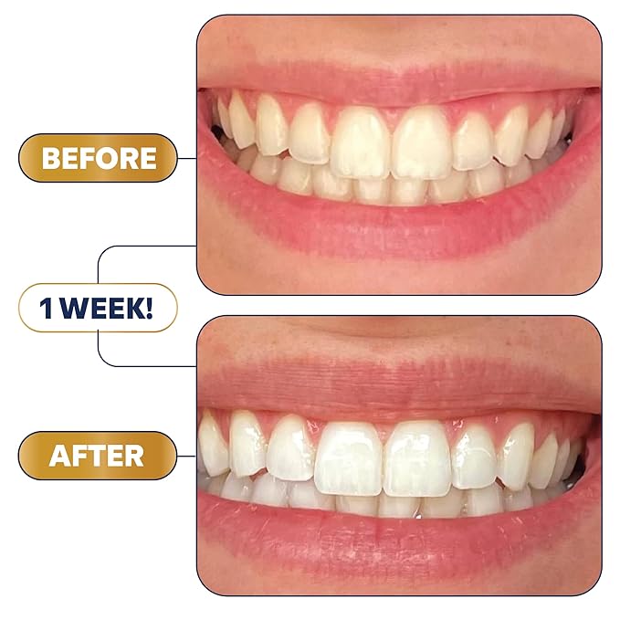 Lumineux Teeth Whitening Strips Kit - 9 Treatments - Peroxide Free - Enamel Safe for Whiter Teeth - Whitening Without The Sensitivity - Dentist Formulated - Sensitivity Free
