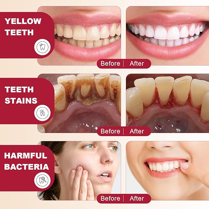 SP-6 Probiotics Whitening Toothpaste, with Probiotics Deep Cleaning Oral Care Removing Teeth Stain & Retain Fresh Breath.