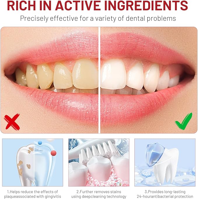 Sp10 Probiotic Toothpaste, Sp-10 Ultra Whitening Toothpaste, Fresh Breath Stain Removal, Deep Cleaning Care(2pcs)
