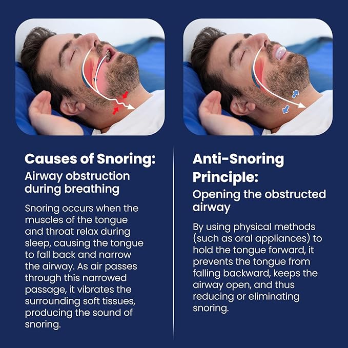Snoring Solution - Anti Snoring Device Mouthpiece Mouth Guard, Comfortable Reusable Snore Stopper, BPA-Free Tongue Retainer for Better Sleep, Easy to Use Snore Solution for Men and Women(O16)