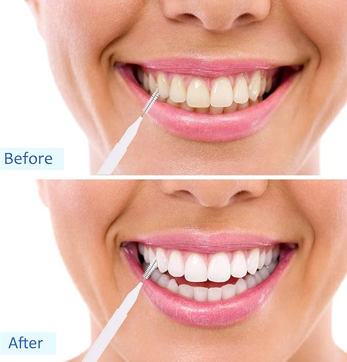 Patelai 100 Pieces Braces Brush for Cleaner Interdental Brush Toothpick Dental Tooth Flossing Head Oral Dental Hygiene Flosser Toothpick Cleaners Tooth Cleaning Tool(White, Light Pink,Multiple Sizes)