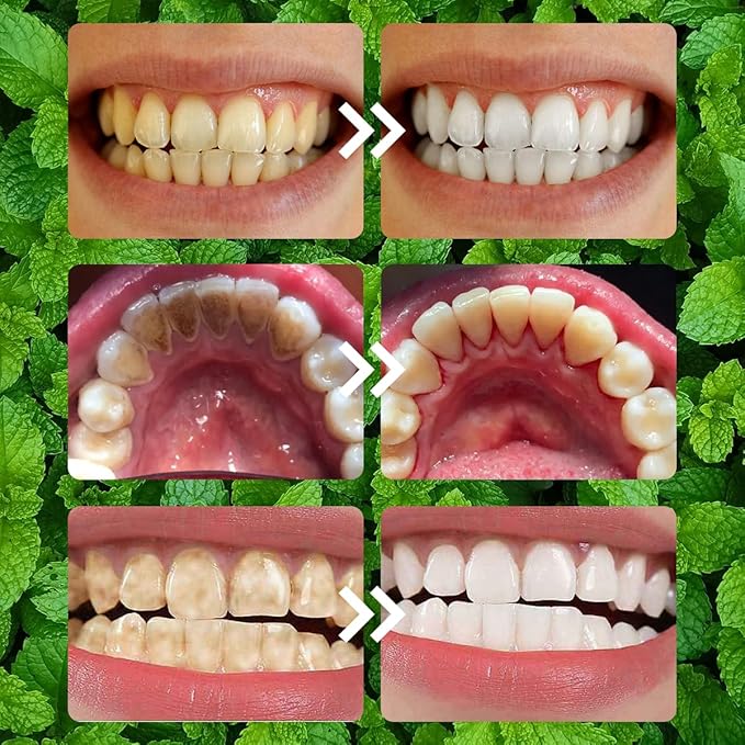 Teeth Restoration Mineral Powder, Oral & Teeth Care Mineral Powder, Effective in Strengthening Tooth and Gums
