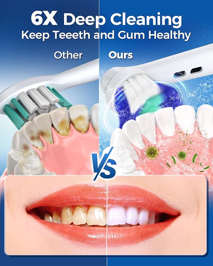 TEETHEORY Rotating Electric Toothbrush for Adults with 8 Brush Heads (2 Types), 4 Modes Deep Clean Electric Toothbrush with Rechargeable Power and 2 Min Smart Timer (7-SkyBlue, p1)