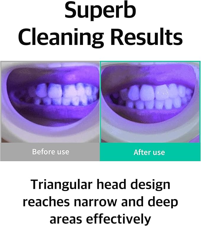Ultra-Fine Bristle Toothbrush(3 Mint Color + 3 White Color) – Triangle Head Manual Toothbrush with 0.017mm Soft Bristles & Ergonomic Thumb Grip for Gentle and Precise Cleaning