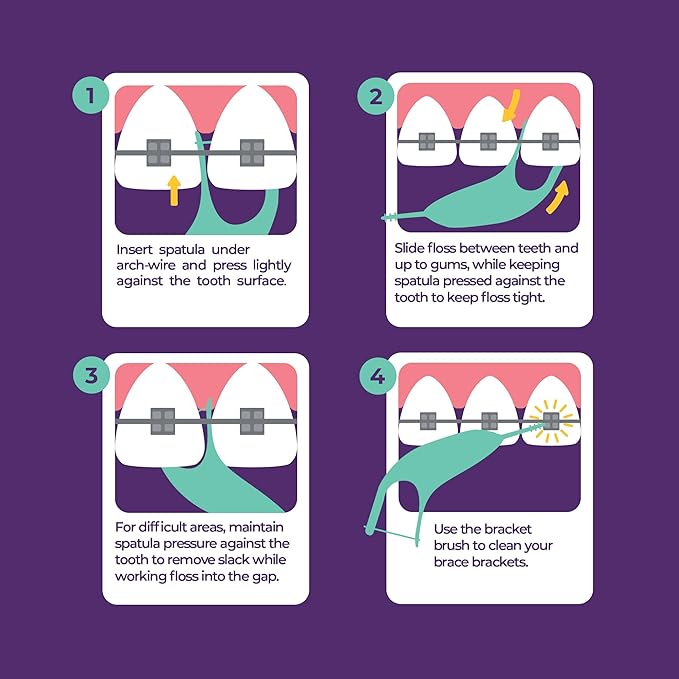 Platypus Orthodontic Flossers for Braces, 30 Count (Pack of 2), Ortho Picks for Adults & Kids, Fits Under Arch Wire, Non-Damaging, Encourage Flossing Habits