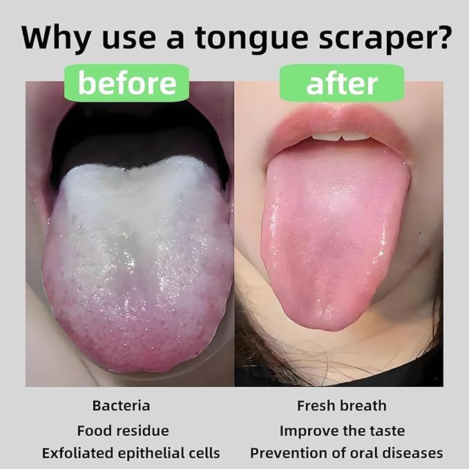 Tongue Scraper Bling Metal Tongue Cleaner for Adults & Kids Diamond Stainless Steel Tongue Scrubber for Oral Care & Hygiene(Black)