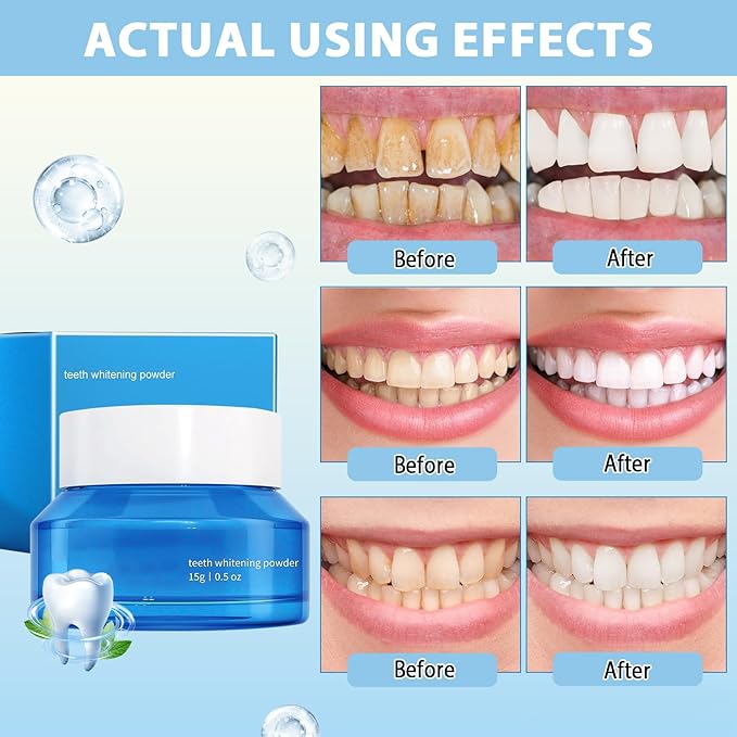 Teeth Whitening Powder, Natural Teeth Whitener, Teeth Whitening Powder Toothpaste, Instant Teeth Whitening and Stain Removal, Fresh Breath (1PC)