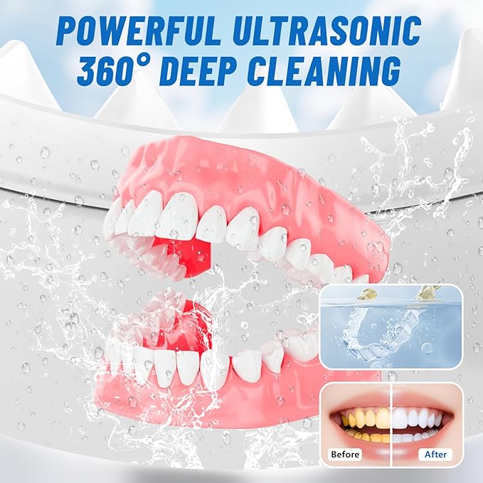 Ultrasonic Retainer Cleaner Machine for Dentures | 45kHz Dental Cleaning Pod for Mouth Guards, Aligner, Nightguard, Braces, Jewelry, Watch | 3 Timer Modes - with Cooling Fan & Split-Design